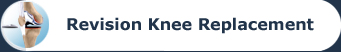 Revision Knee Replacement